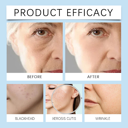 Title 10, Gentle and Moisturizing Facial Skin Cream Tende...