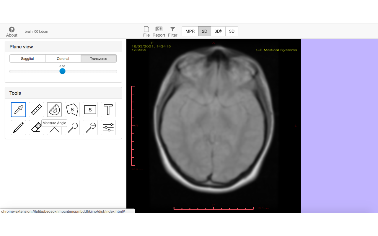 Med3D DICOM Preview image 4