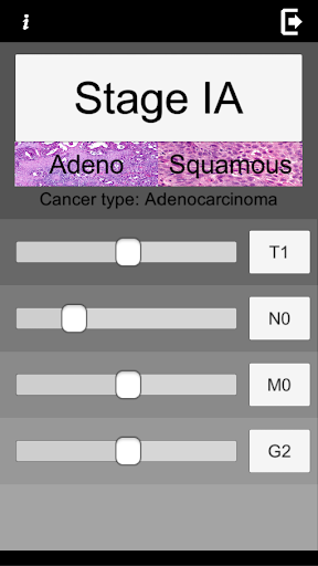 Esophageal Cancer Staging TNM