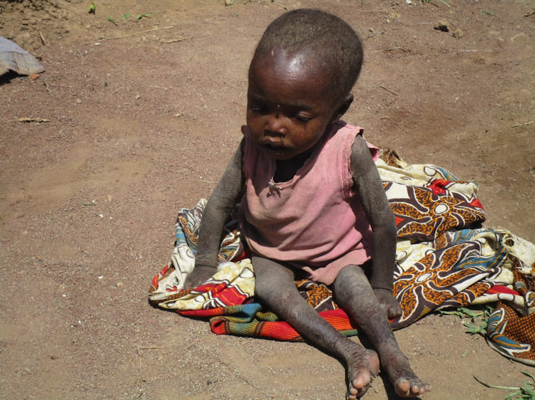 Malnourished child in Sabor, Baringo South on Tuesday.