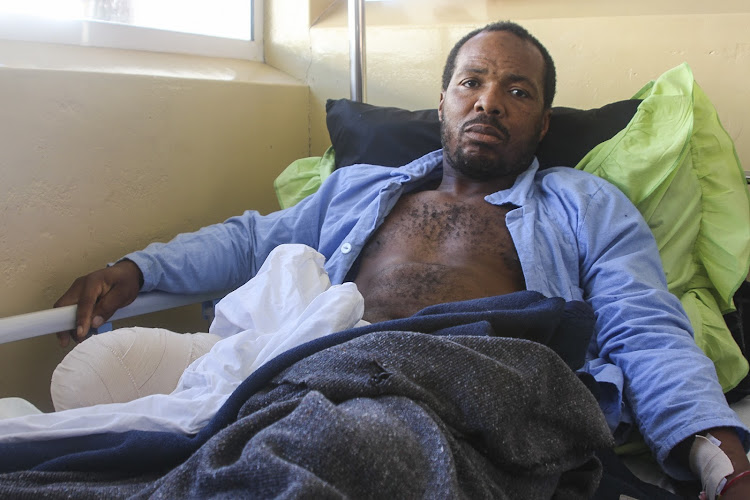 Madzabudzabu Kunene, a former leader of the Swaziland Youth Congress, the military wing of the People’s United Democratic Movement, had his leg amputated after he was shot by eSwatini’s armed forces during the protests.