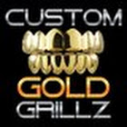 customgoldgrillz