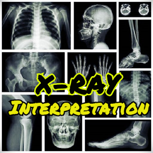 x-ray interpretation guide 1.0 APK + Мод (Unlimited money) за Android