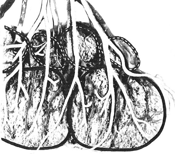 This partial view of the fetal side of a placental disc of tupaia shows two large and four smaller lobules, both covered by fetal vessels