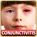 Cover Image of ダウンロード Help for Baby Conjunctivitis & Pinkeye in Children 1.4 APK