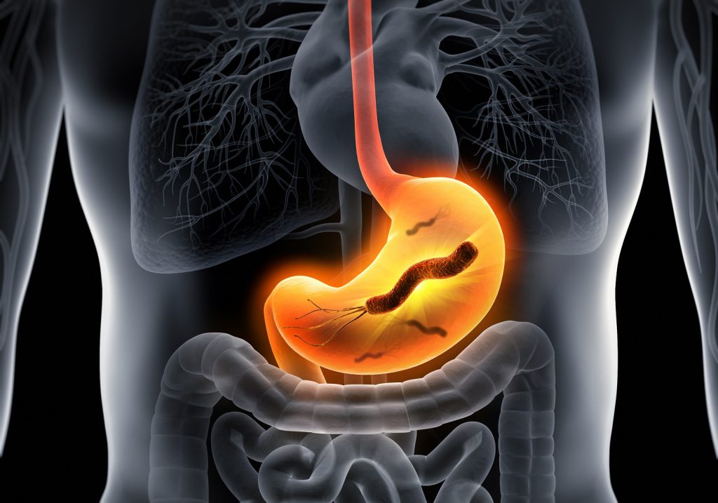  جرثومة المعدة Helicobacter pylori 