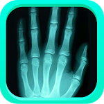 XRay Scanner Plus Prank Apk