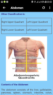 Radiographic Positioning - Abdomen, Chest & Pelvis(圖4)-速報App