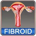 Cover Image of Herunterladen Uterine Fibroid Causes Symptoms Types & Treatment 1.3 APK