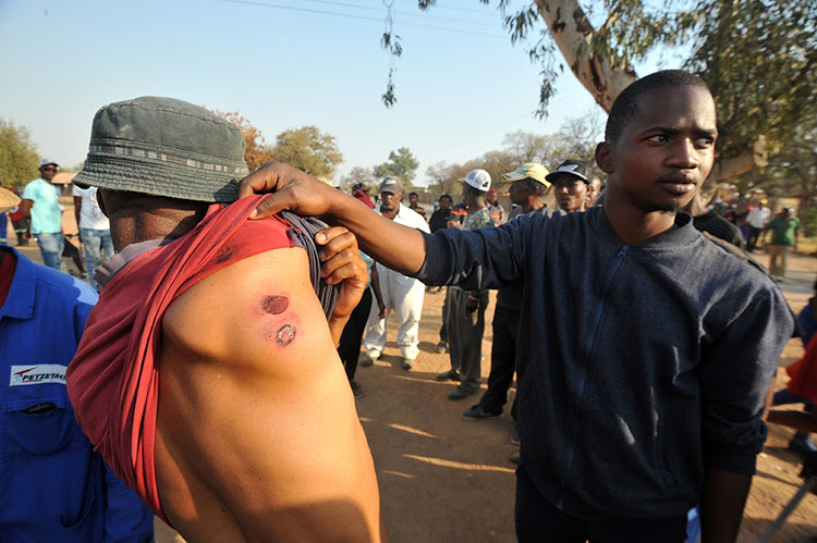 This man was injured in Maboloka when residents of Bataung-ba-Hlalele clashed with police.