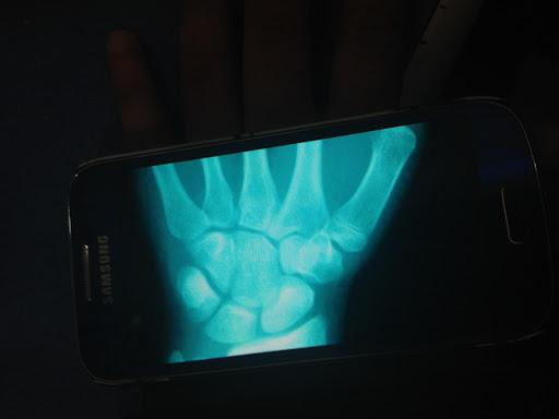 Scanner-xray radiology pranks