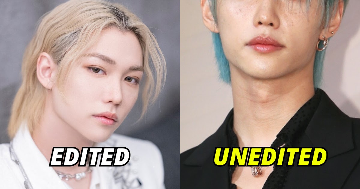 The Freckles Are Out — Stray Kids' Felix Shines In Unedited Moments At The  BVLGARI Event That Show What He Looks Like IRL - Koreaboo