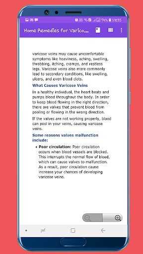 Home Remedies for Varicose Veins