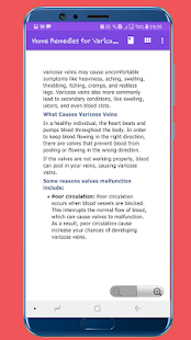 Home Remedies for Varicose Veins(圖4)-速報App