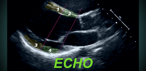 LEARN THE FULL ECHO PROTOCOL