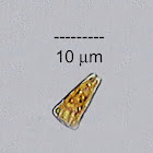 Epilithic Diatom