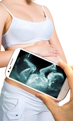 Ultrasound Scanner Prank