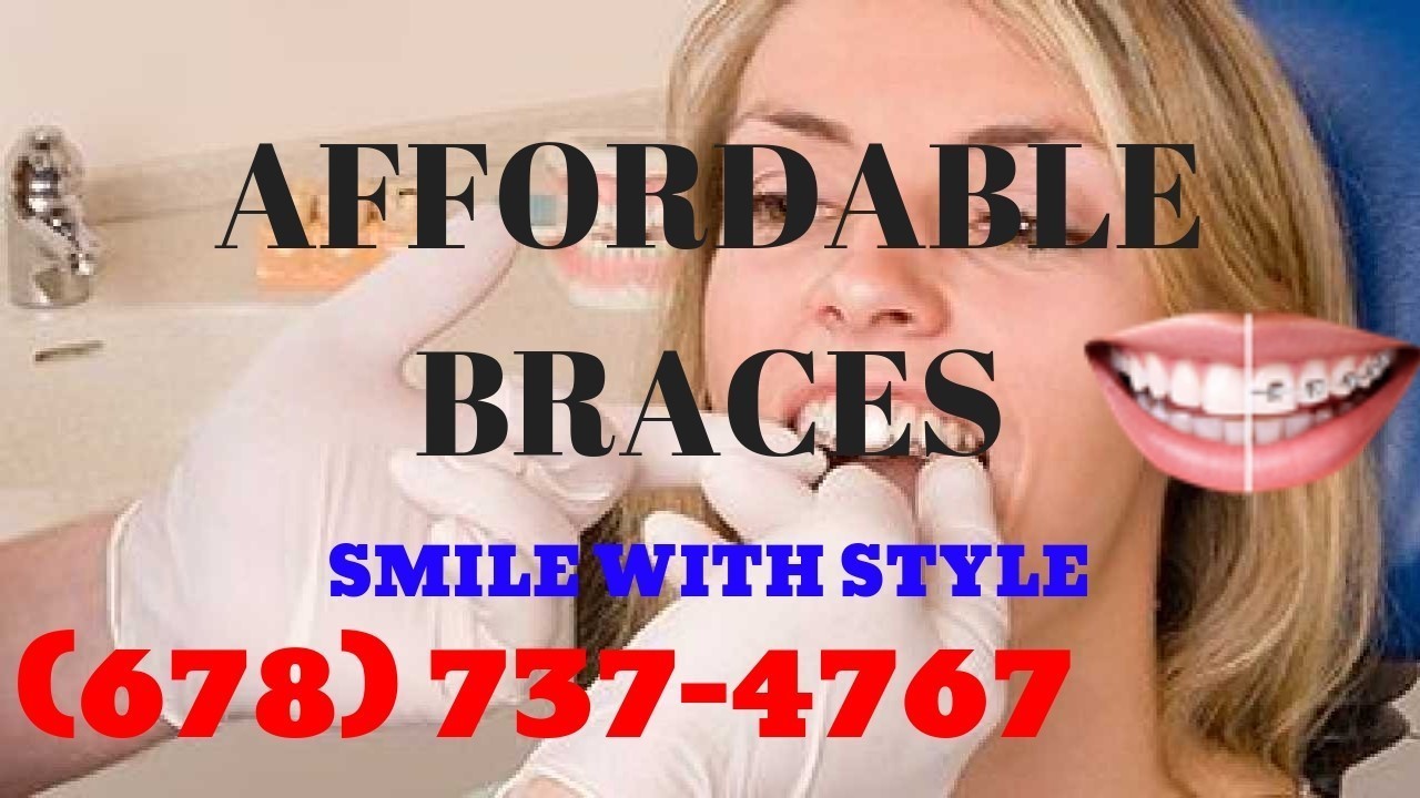 Braces Price Quote In Atlanta Ga