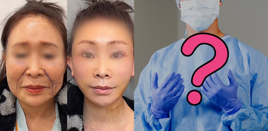 TikTok's Dr. Kim Goes Viral For Botched Plastic Surgery Results