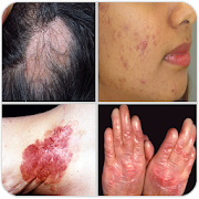 All Skin Diseases and Treatment- A to Z 15.1.4.28 Icon