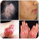 All Skin Diseases and Treatment- A to Z 15.1.4.28 下载程序