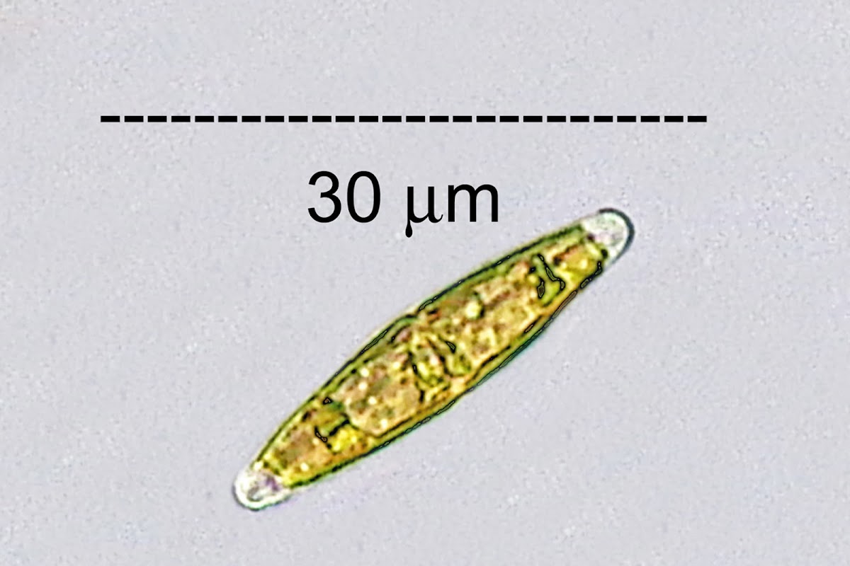 Epilithic Diatom