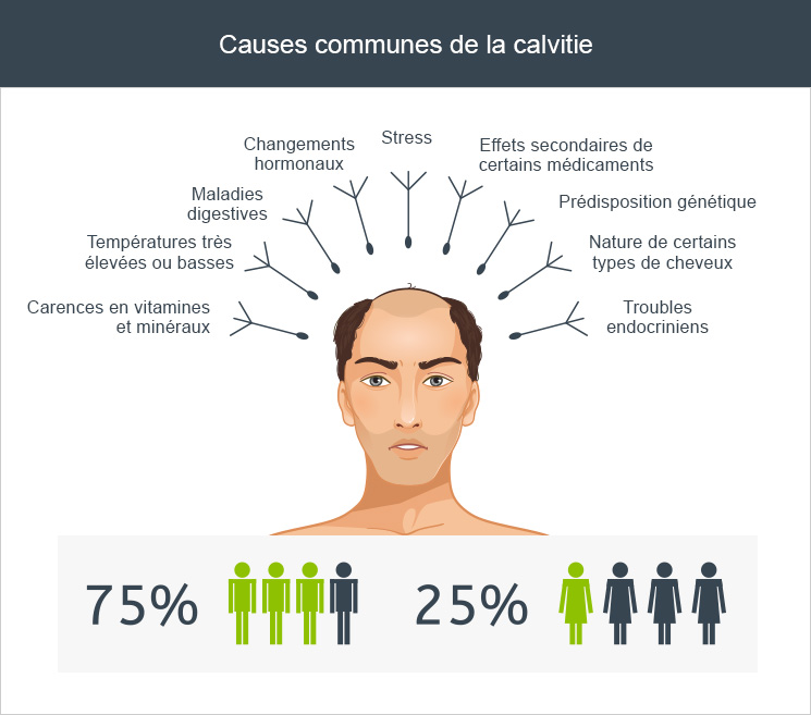 Causes calvitie