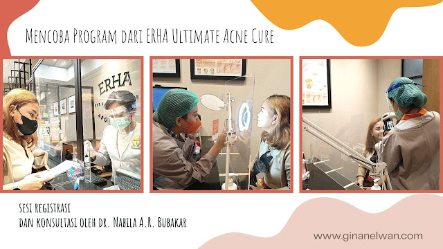 Menghilangkan Komedo dengan Comedoless and Poreless Program dari ERHA Ultimate Acne Cure