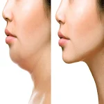 Cover Image of डाउनलोड How To Lose Face Fat 11.0 APK