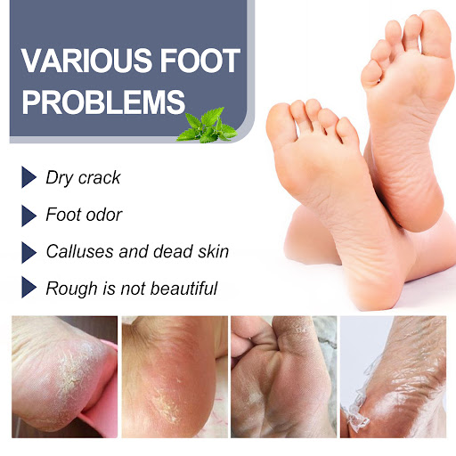 Title 3, Foot Chapped Replenishment Care Spray Moisturiz...