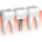 Item logo image for Top Dental Implant Services