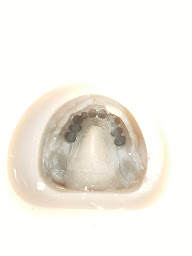 Photo n°15 de Laboratoire Dentaire Kady Diakité à Romorantin-Lanthenay (Centre de prothèses dentaires)