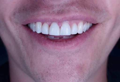 Woodbury Park Dental Surgery Tunbridge Wells - Thumbnail