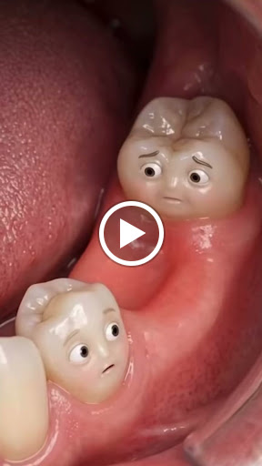 🦷 Dental Implants in Siliguri – Restore Your Smile with Confidence post image