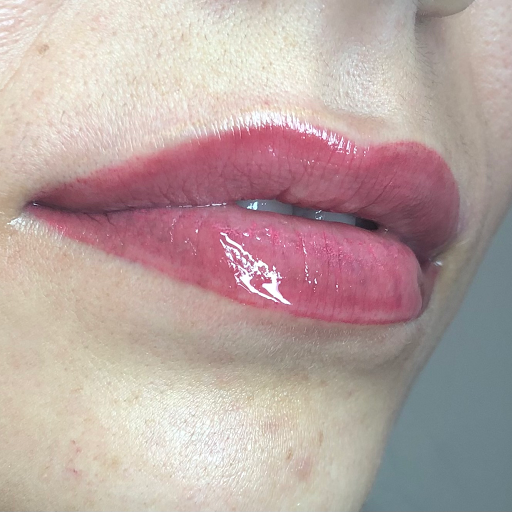 Permak'Lady Cabriès - Thumbnail