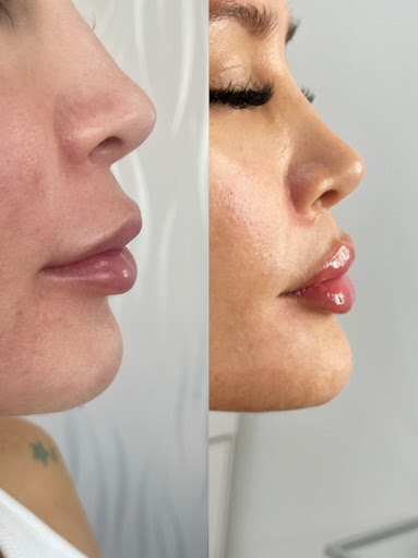 Deluxe Med Spa Beauty