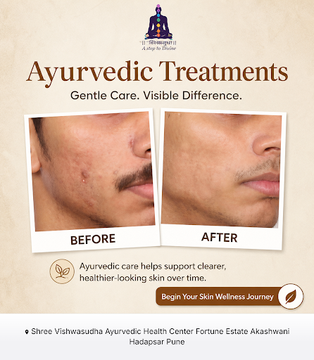 Experience holistic wellness at Shree Vishwasudha Ayurvedic Clinic, where our expert practitioner… post image