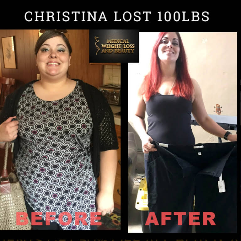 Getting The Specials Offers - Rejuvenation Med Spa Weight Loss To Work thumbnail