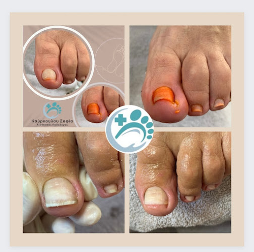 Κούρκουλου Σοφία, Αισθ. Ποδολόγος , Θεραπεία κ Αισθητική Άκρων - Γιατρός