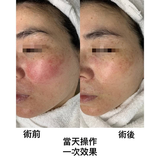 喬伊曼CHIAO Yi肌膚概念館評價、營業時間、服務項目、價格 - 醫護級皮膚管理與問題肌膚調理專家