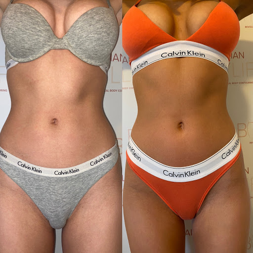 Body Contour Club North West - Thumbnail