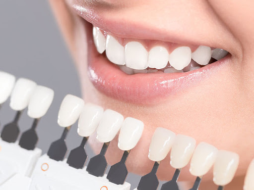 http://dentalclinicahmedabad.in/tooth-colored-filling-composite.php