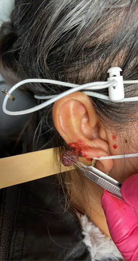 la Piel Perfecta laser center - Thumbnail