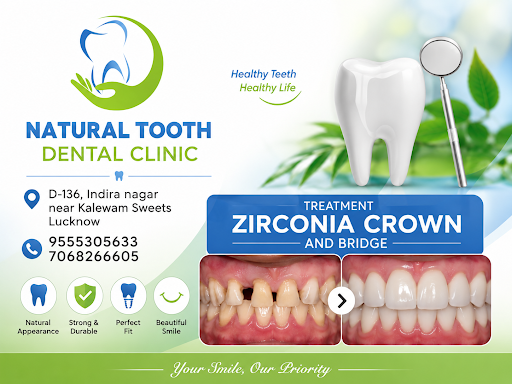 ✔ Natural-looking teeth restoration post image
