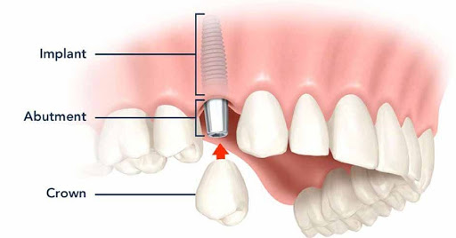Manchester Family & Cosmetic Dentistry - Thumbnail