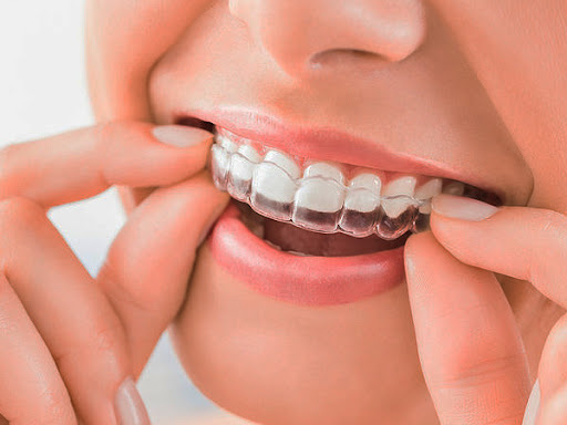HB Smile Dental - Thumbnail