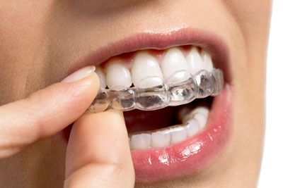 Huron Valley Dental - Family & Emergency Dentistry - Thumbnail