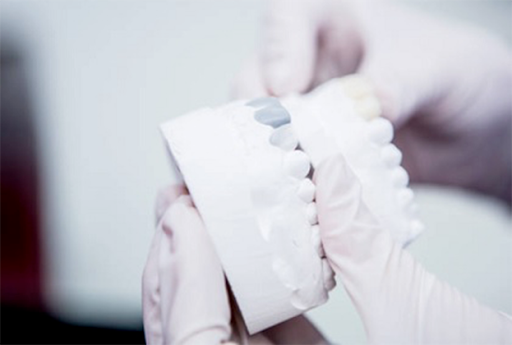 Laboratorio Odontotecnico di Musanti Roberto - Italy