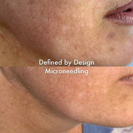 Defined by Design - Skincare + Lash Extensions - Thumbnail