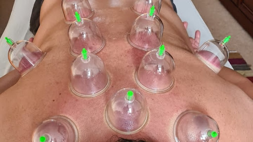Nur Therapy Cupping Centre